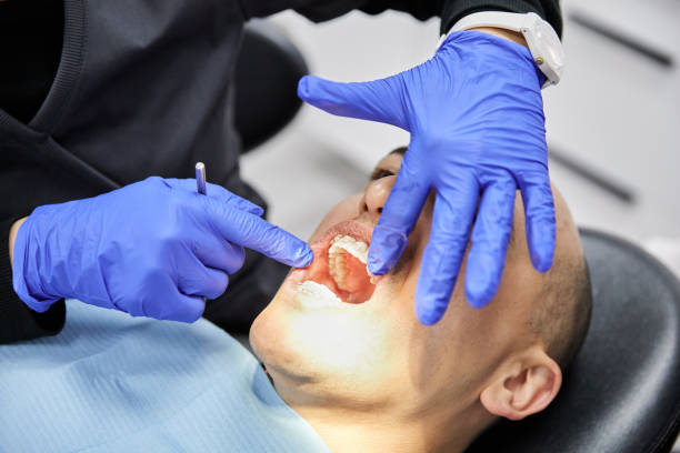 Best Emergency Dentist for Lost Fillings or Crowns in Wahneta, FL